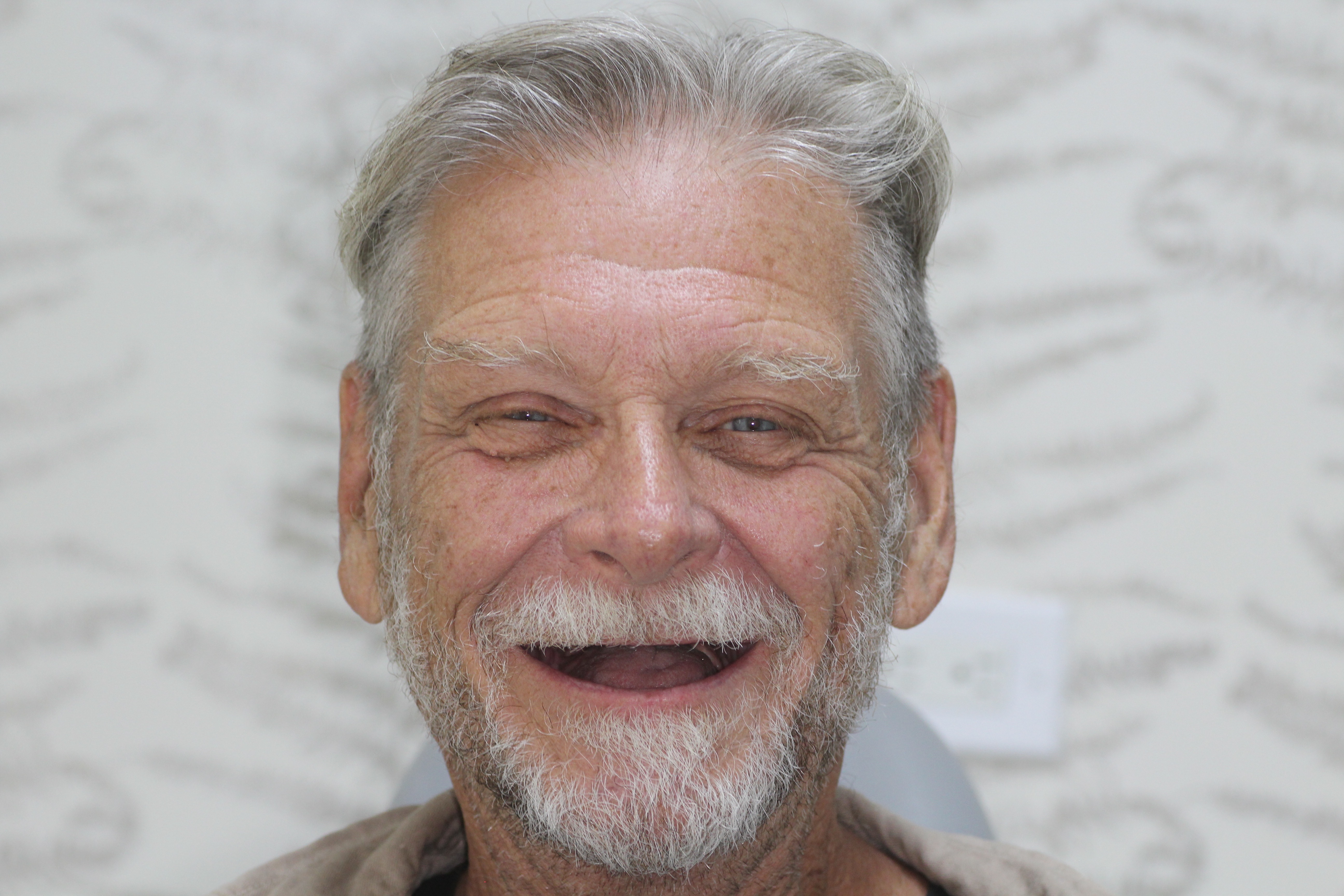 Antes del tratamiento